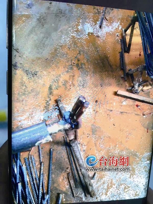 鋼筋扎胸 心臟破裂 他奇跡般地活了下來！