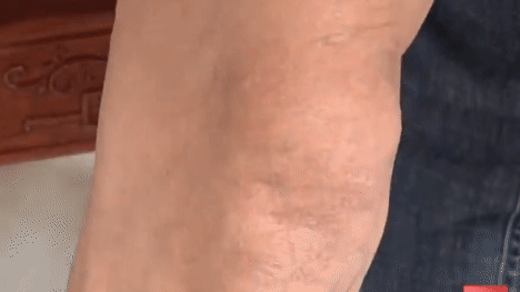 兄弟倆為劫財持槍傷人潛逃26年,落網時“家里有礦”