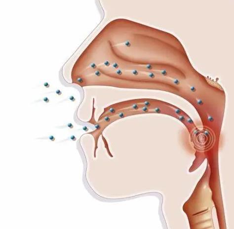 咽炎的癥狀是什么?得了咽炎該怎么辦?為什么會患上咽炎