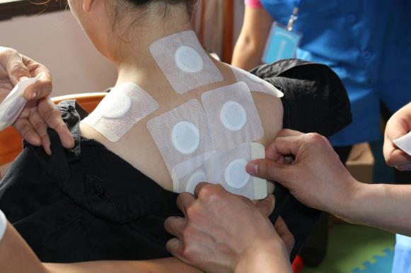 三伏貼每個人貼的中藥都一樣嗎？三伏貼貼的位置在哪里？