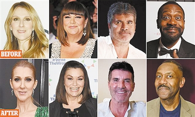 減肥要適度！脂肪流失會(huì)導(dǎo)致“節(jié)食臉”